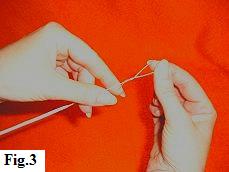 Balloon Release Preparation, Step 3